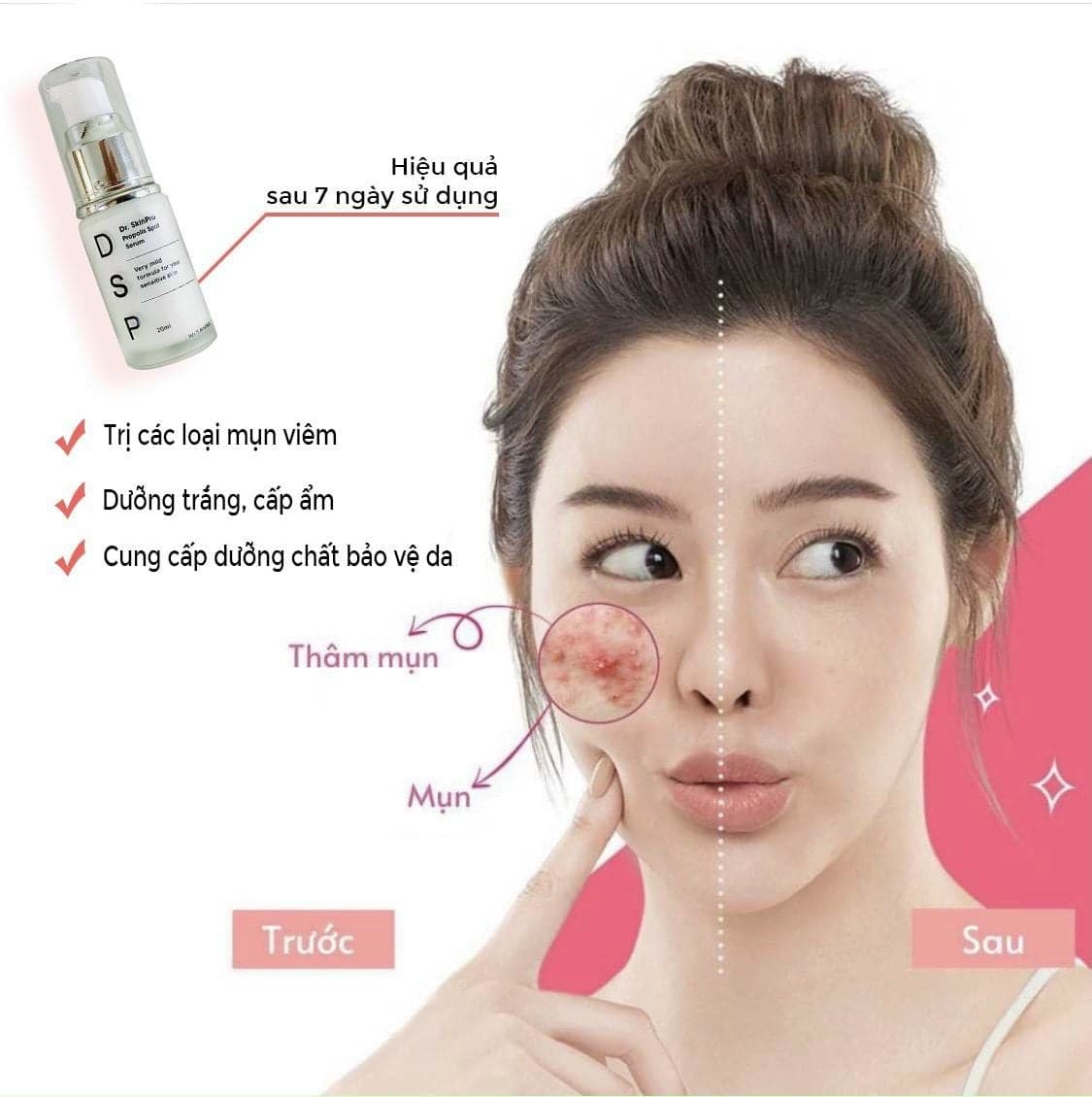 SERUM TRỊ MỤN DR.SKINPRO ảnh 3